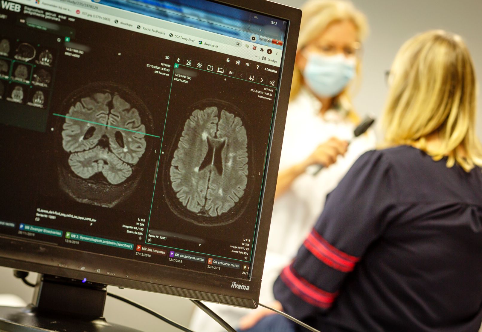 Neurologie0037