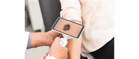 Dermatologie dermoscopie