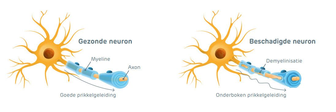 Neuron