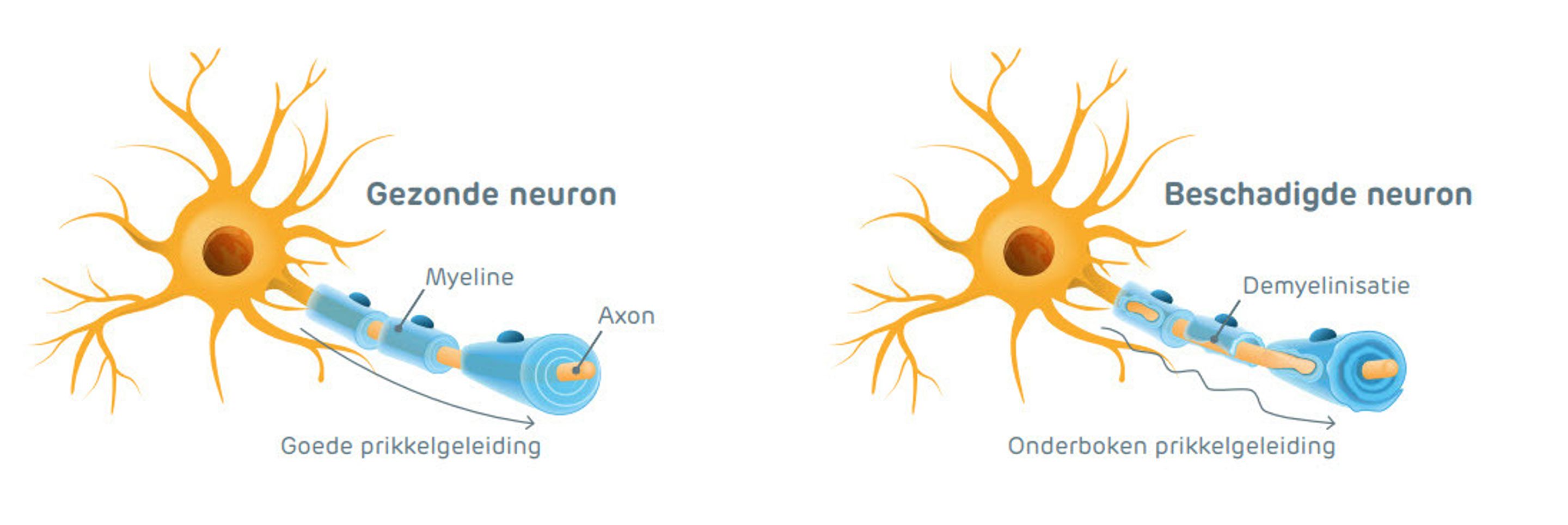 Neuron